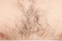 Hairy Skins